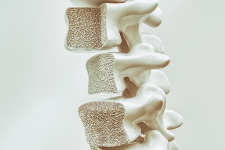 7 Yoga Poses to Help Alleviate the Symptoms of Osteoporosis - Yoga Pose